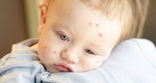 Repelentes mosquitos bio para bebés