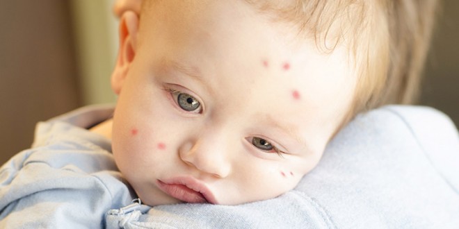 Repelentes mosquitos bio para bebés