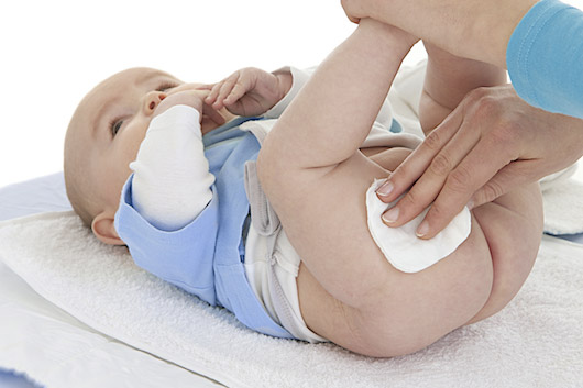 dermatitis del pañal