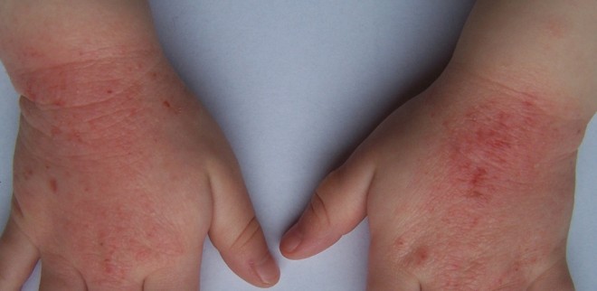 iwonatura serum reparador problemas de la piel